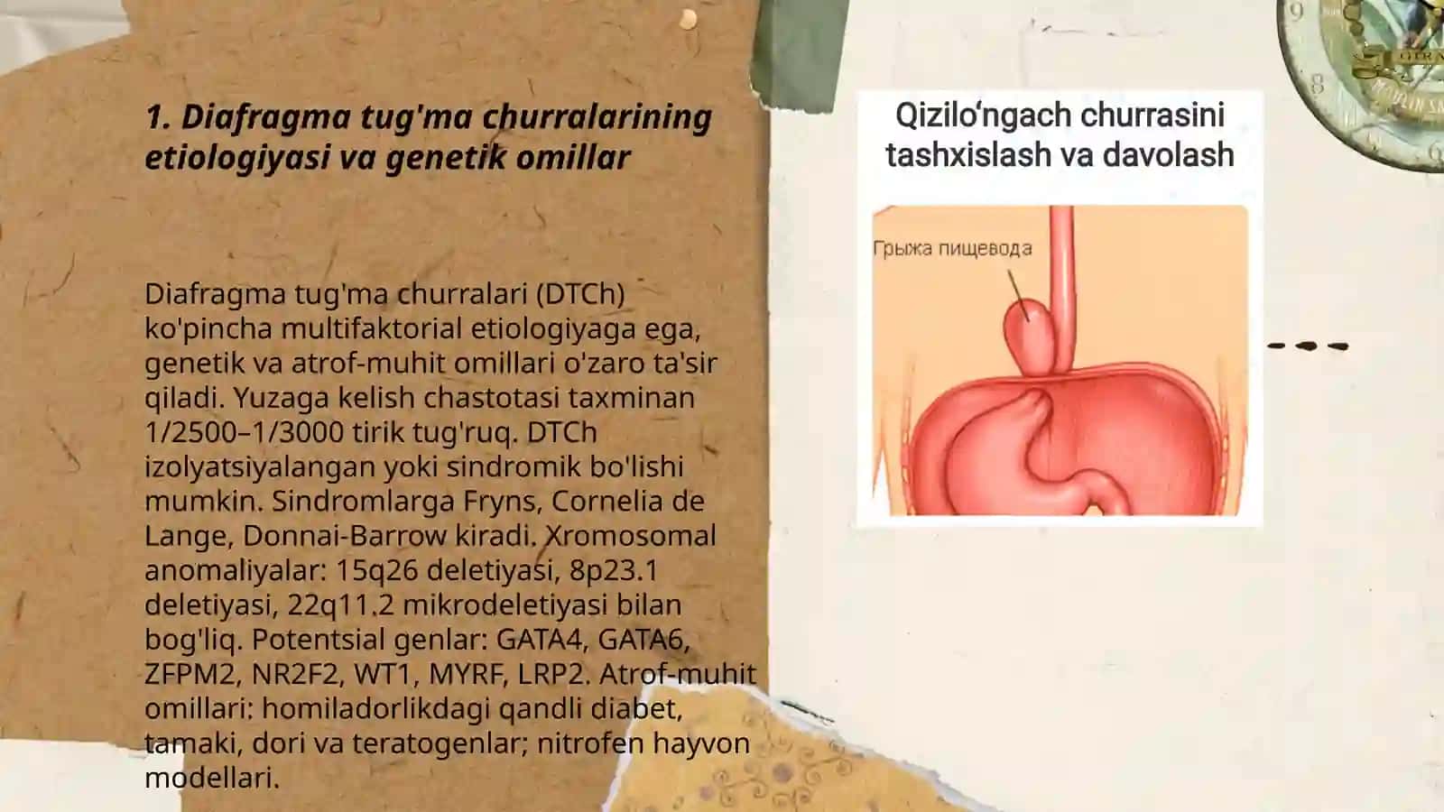 Diafragma tug'ma churralari etiologiyasi klinikasi davolash diagnostika 3