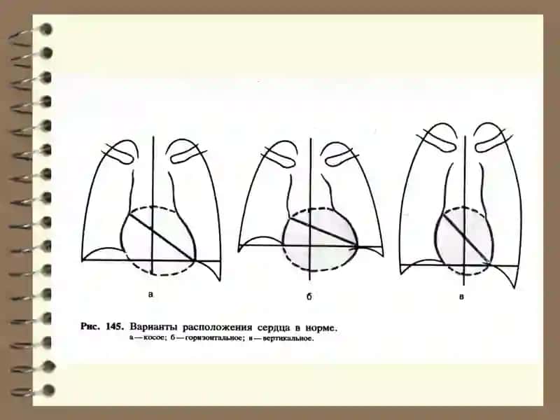 Yurak-qon tomir tizimini radiatsion tekshirish usullari 3