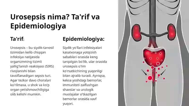 Urosepsis 3
