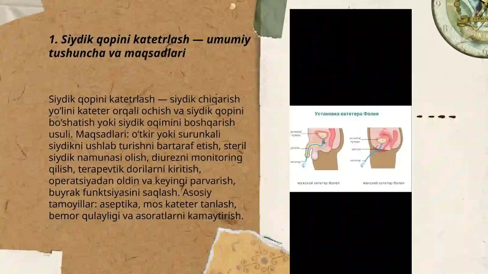 Siydik qopini katetrlash texnikasi 3