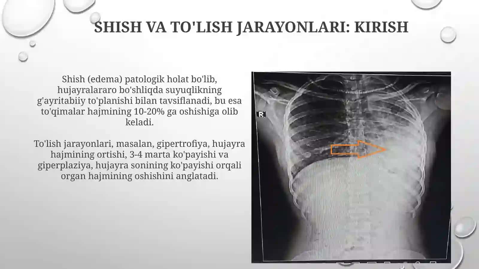 Shish va o’rin to’ldirish jarayonlari 3