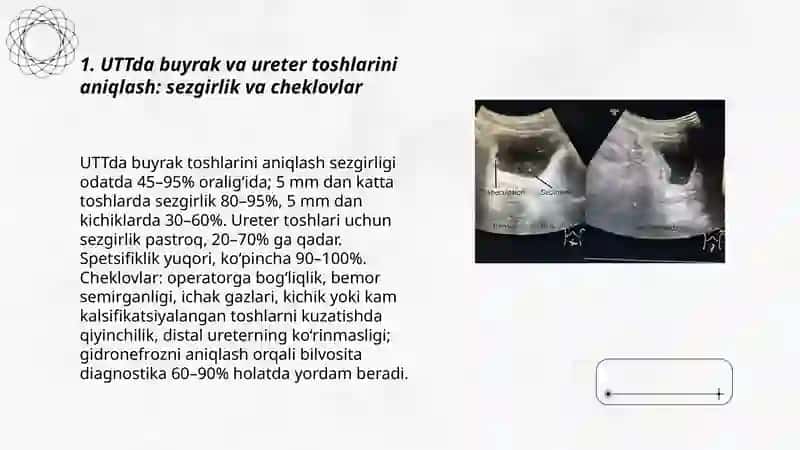 siydik tosh kasalligi UTT, MRT, KT tekshiruvlarida Malikjonova 3