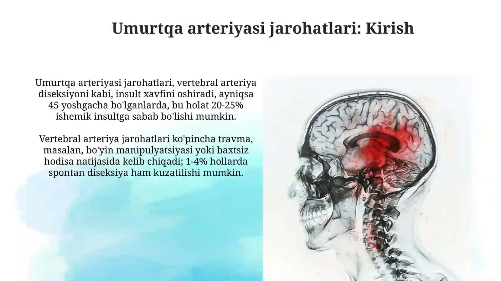 Umurtqa arteriyalari shikastlanishlari. Bosh miya qon bn taminlanishi 3