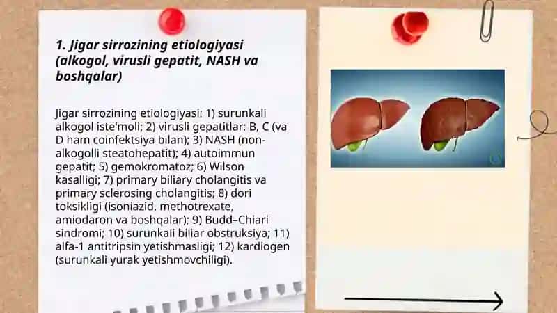 Jigar sirrozi.Jigar yetishmovchiligi 3