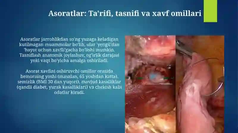 Asoratlar: Ta'rifi, tasnifi va xavf omillari 3
