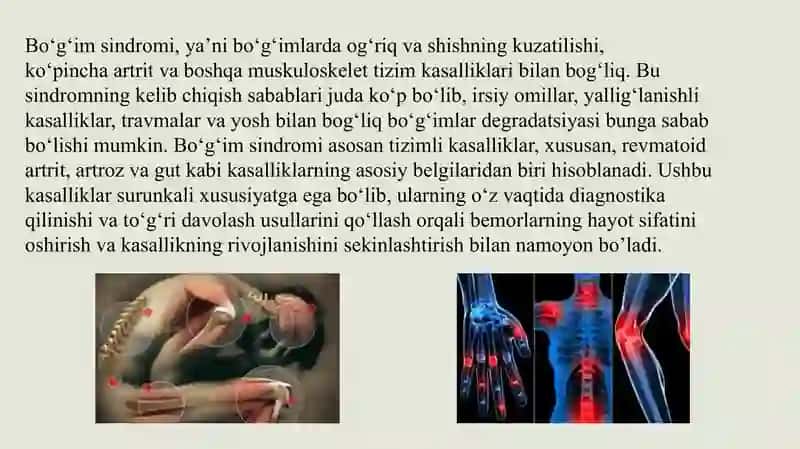 Bo'g'im sindromi haqida pptx taqdimot 3
