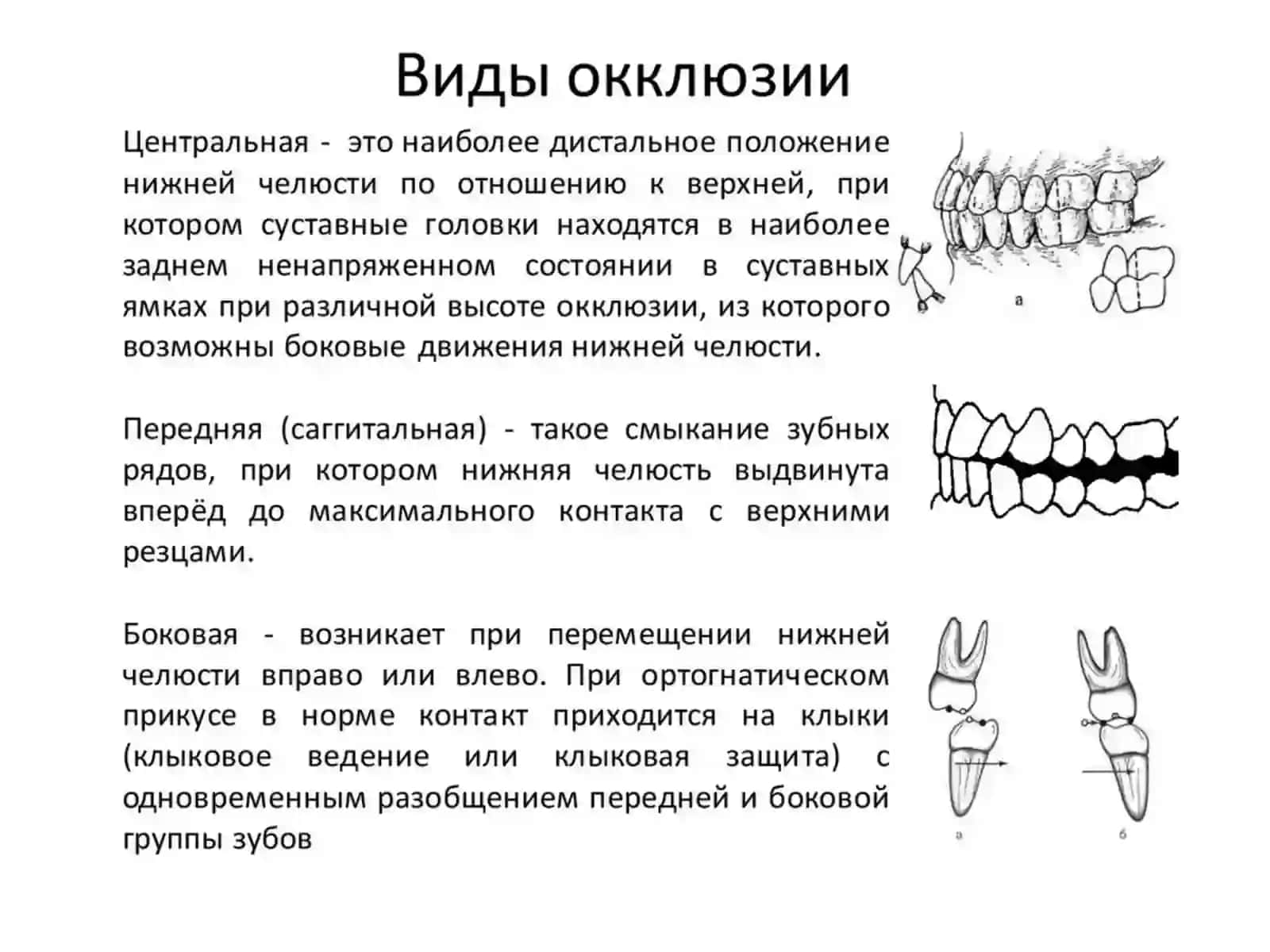 Общая характеристика прикусов физиологических и патологических 3