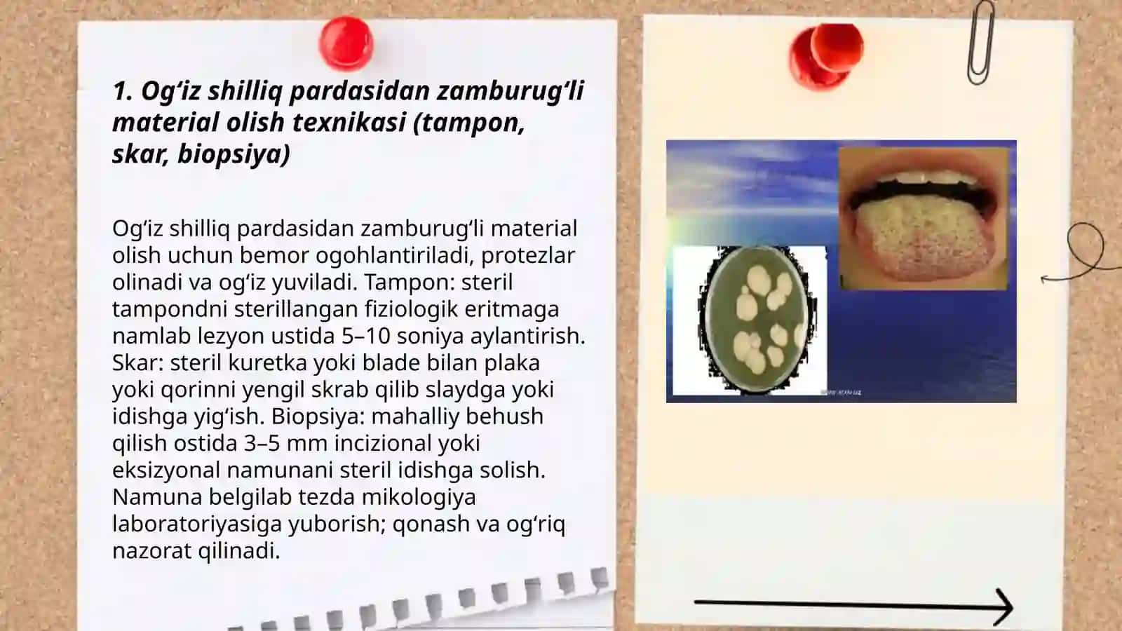 Og'iz shilliq pardasidan zamburug'li material olish texnikasi 3