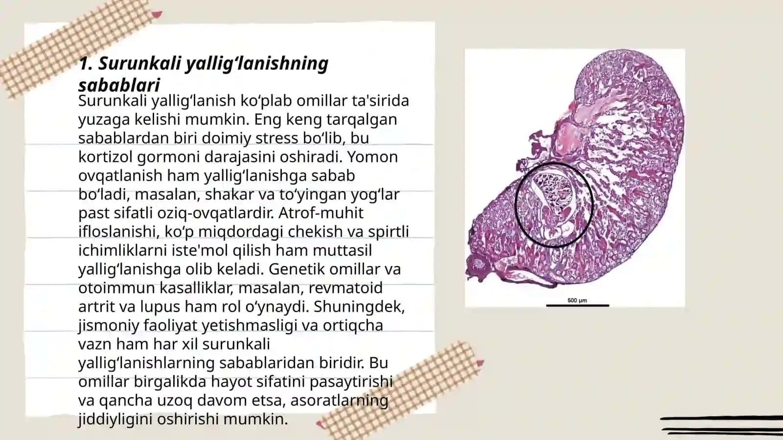Surunkali yallig‘lanish 3