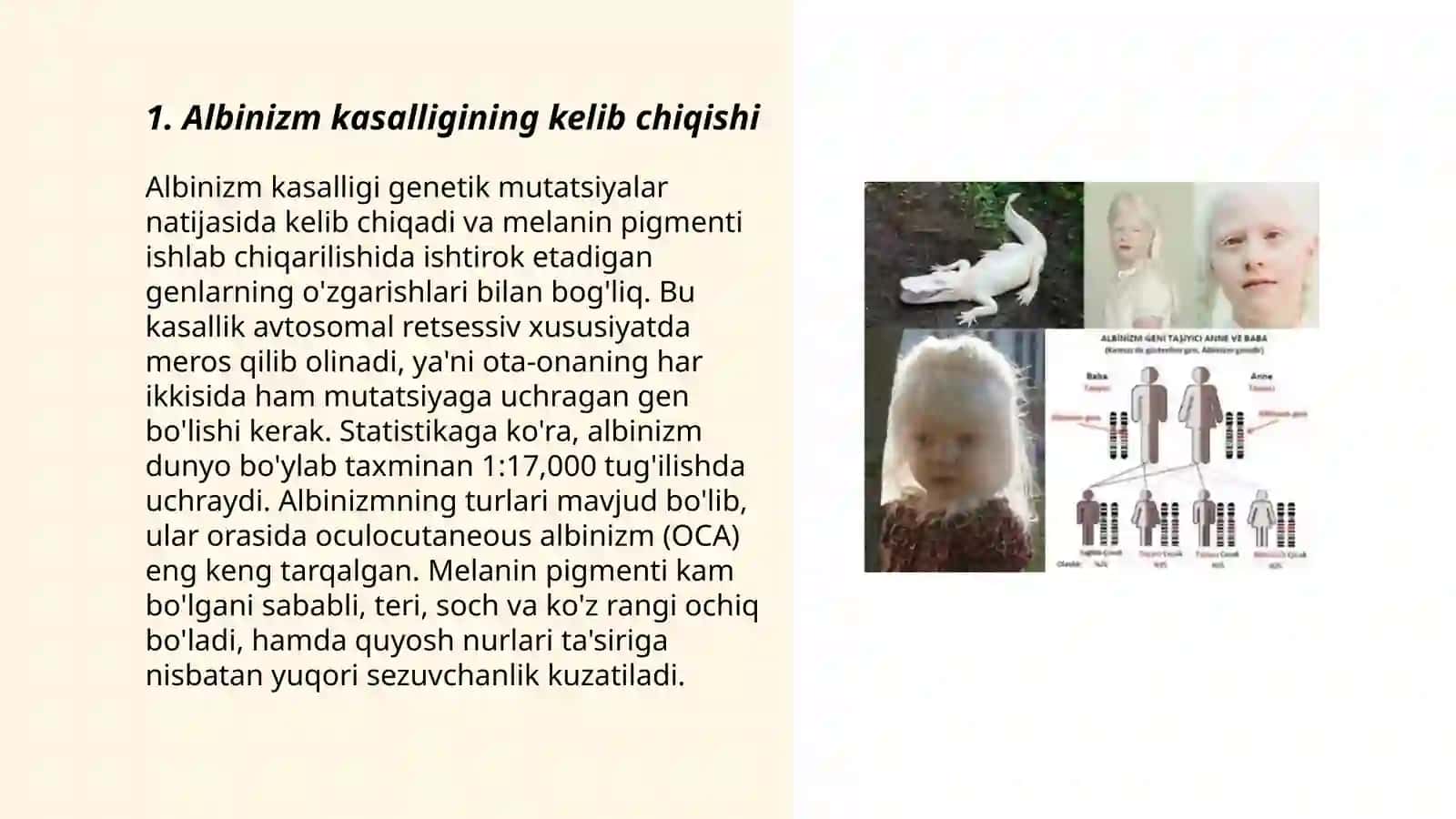 Albinizm kasalligi klinikasi va davolash profilaktikasi 3