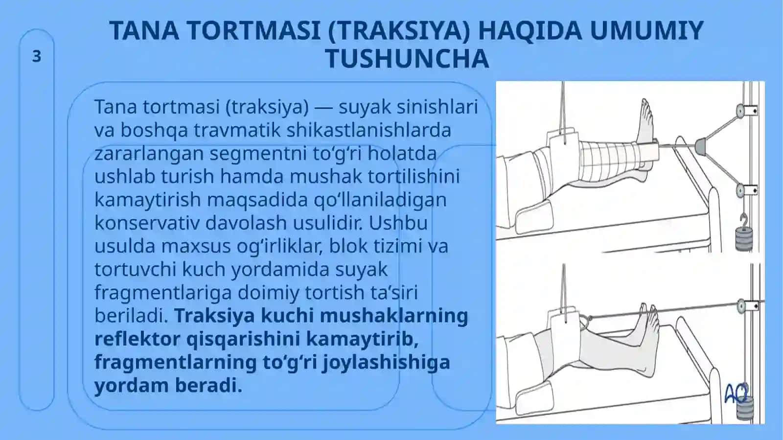 Tana tortmasi (traksiya) 3
