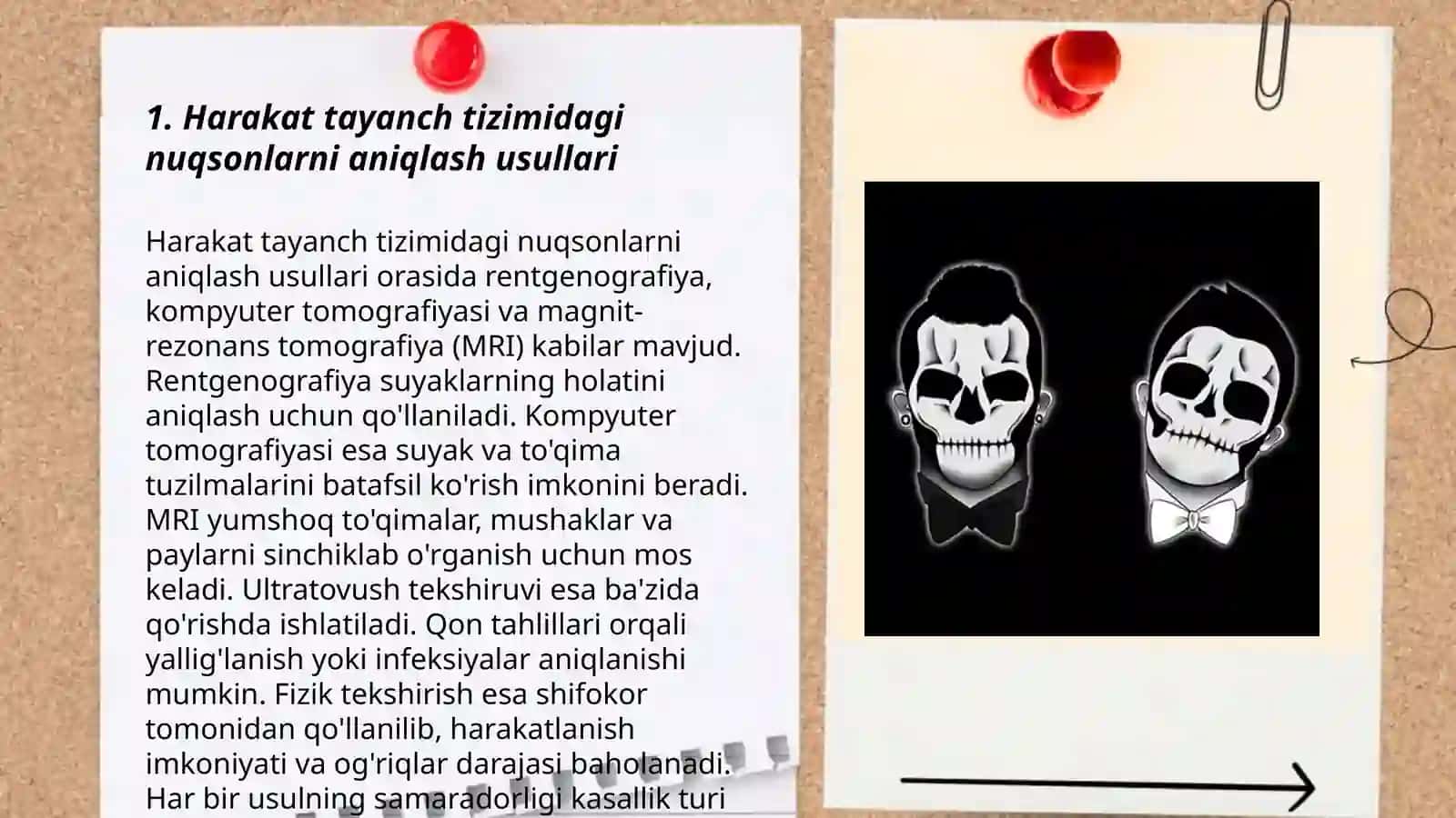 Harakat tayanch muvozanat tizimida nuqsoni bo'lgan bolalar bilan ishlash 3