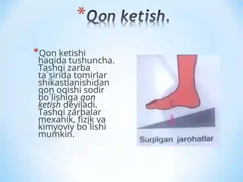 REANIMATSIYA VA OZIQSIZLANTIRISH QON KETISHI TURLARI TIBBIY YORDAM 3