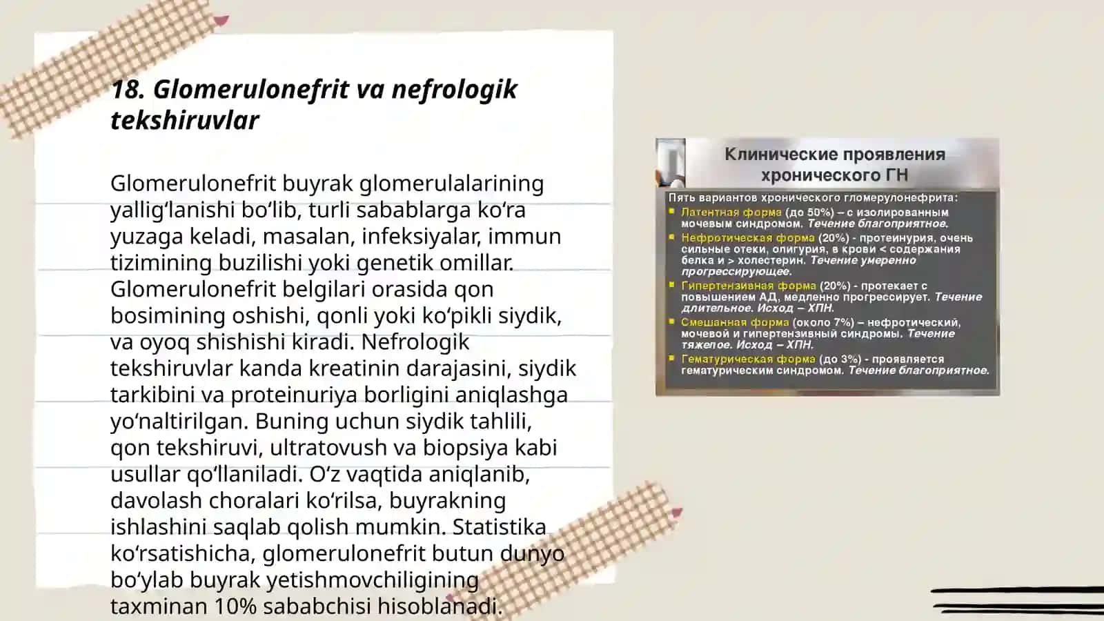 Glomerulonefrit 3