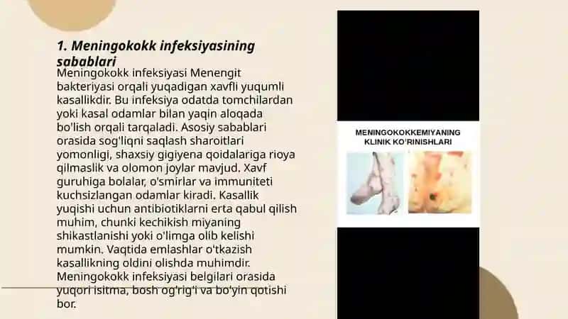 Meningokokk Infeksiyasi 3