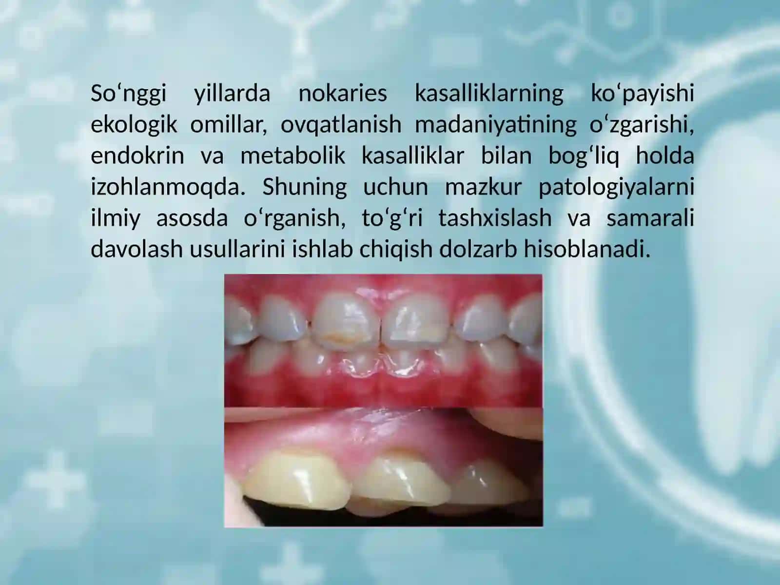 TISH TO'QIMALARINING FOLIKULYAR RIVOJLANISH DAVRIDA YUZAGA KELADIGAN SHIKASTLANISHLAR 3