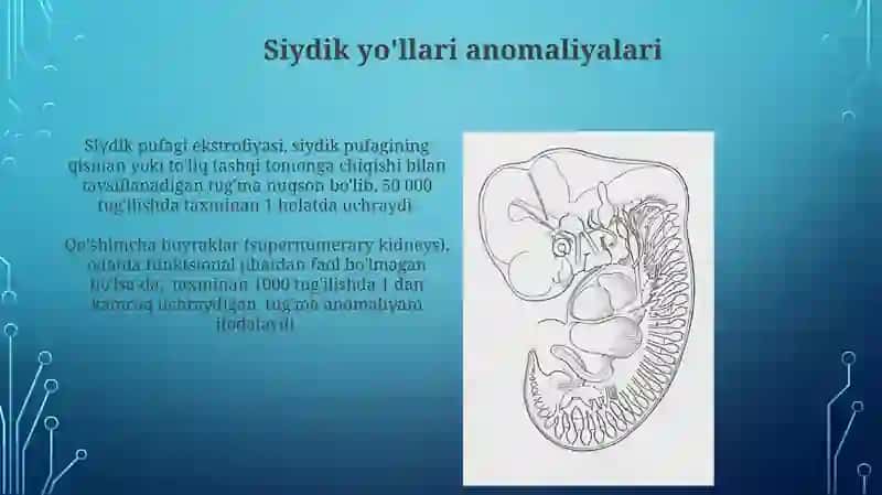 Siydik ajratish tizimi rivojlanishi va uning anomaliyalari 3
