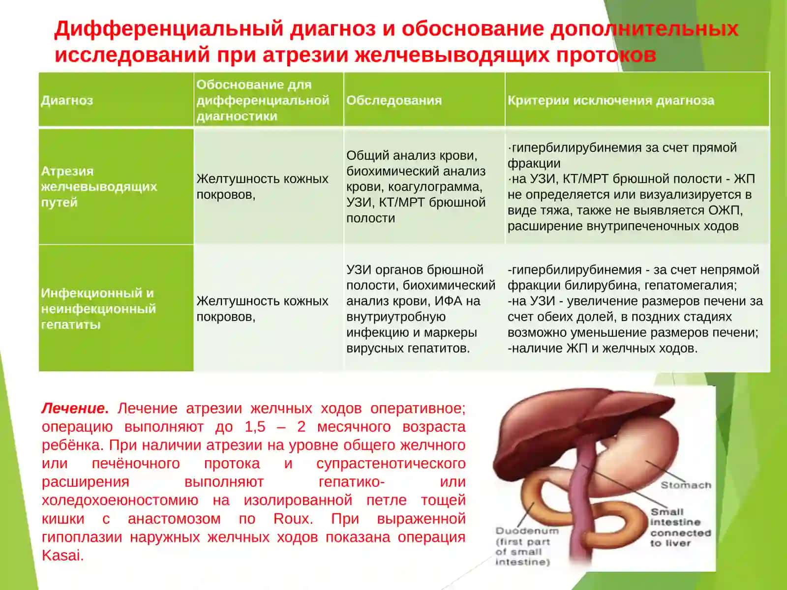 Атрезия желчных протоков 3