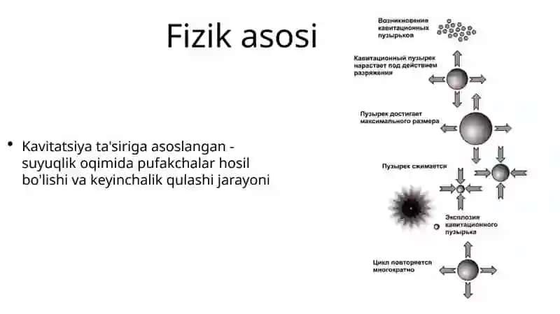 Ekstrokorporal zarb to’lqinli litotripsiya 3
