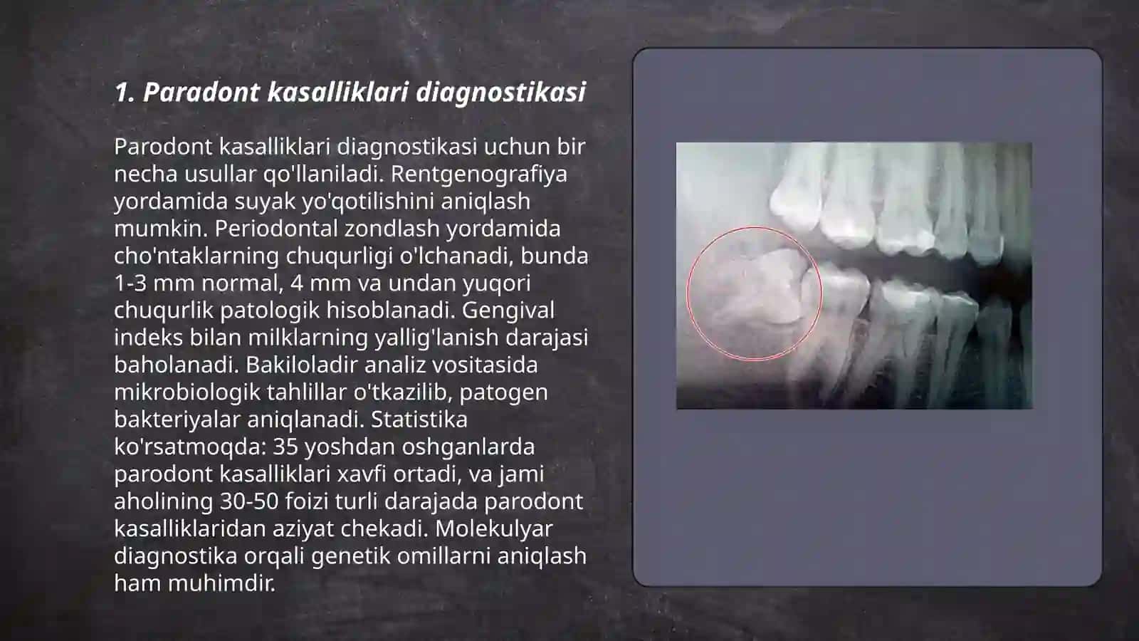 Paradont Kasalliklarida Rentgenogramma va Ortopotomografiya 3