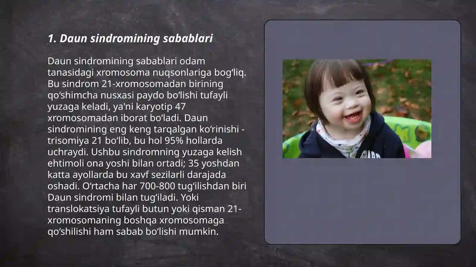 Daun sindromi 3
