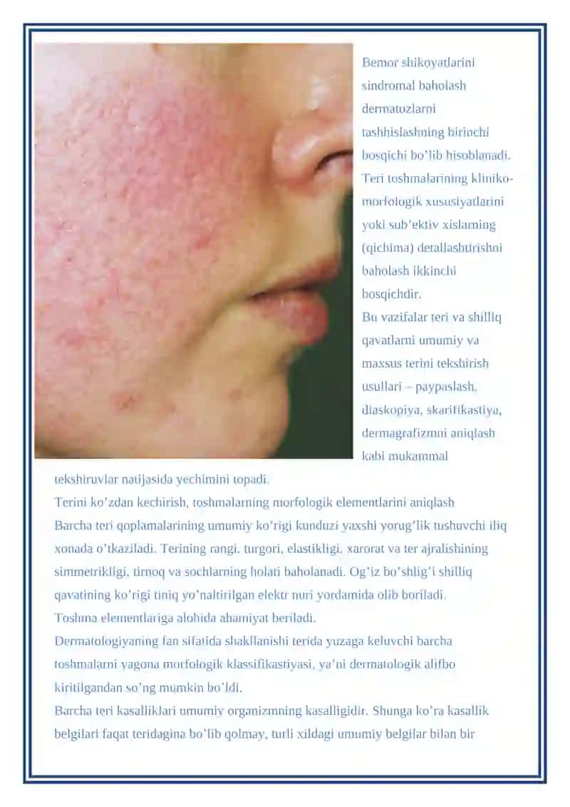 TERINING DERMATOZLAR NASLIY KASALLIKLARI QANDSIZ DIAPED KASALLIGI 3