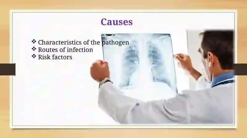 Tuberculosis 3