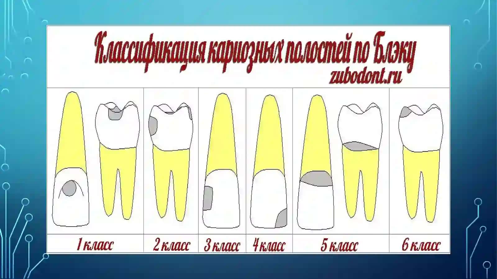 FANTOMLARDA5-6-SINFKARIOZ BO’SHLIQLARINI CHARXLASH VA PLOMBALASH 3
