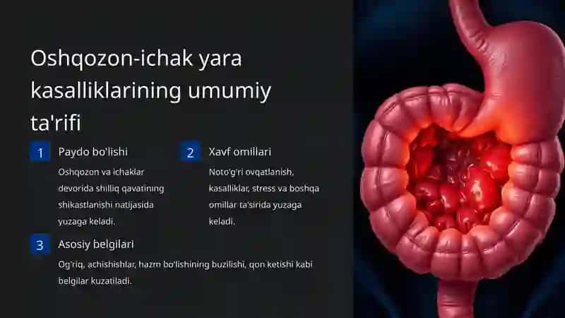 Giperasid holatlarda va oshqozon-ichak yara kasalliklari 3