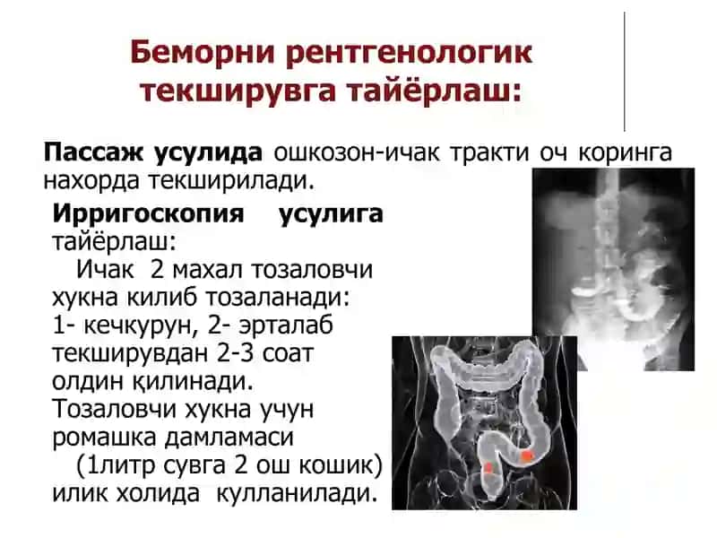 Ҳазм тизими аъзоларининг комплекс нур диагностикаси 3