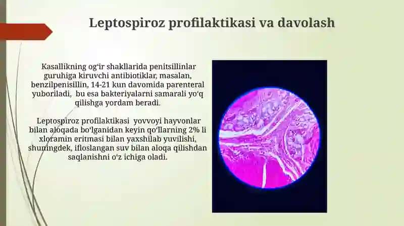 Leptospirozlar morfologiyasi, keltirib chiqaruvchi kasalliklari 3