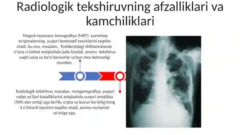 Yuqori nafas yollari kasalliklarini rentgenologik tekshirish usullari 3