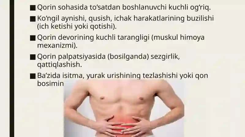 O‘tkir qorin sindromi 3