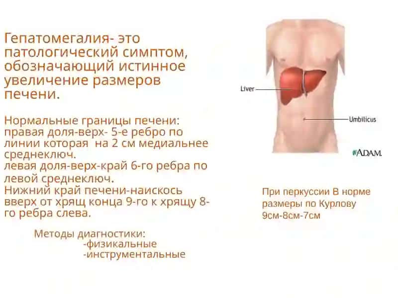 Синдром Гепатомегалии 3