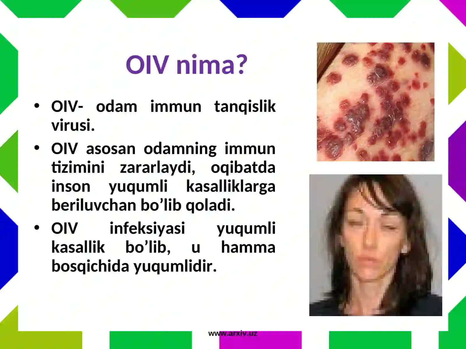 OIV - Odəm immun tanqislik virusi 4