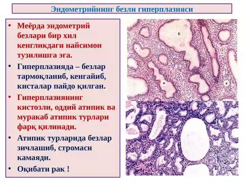 АЁЛЛАР ЖИНСИЙ АЪЗОЛАРИ АНАТОМИЯ ВА ФИЗИОЛОГИЯСИ 4