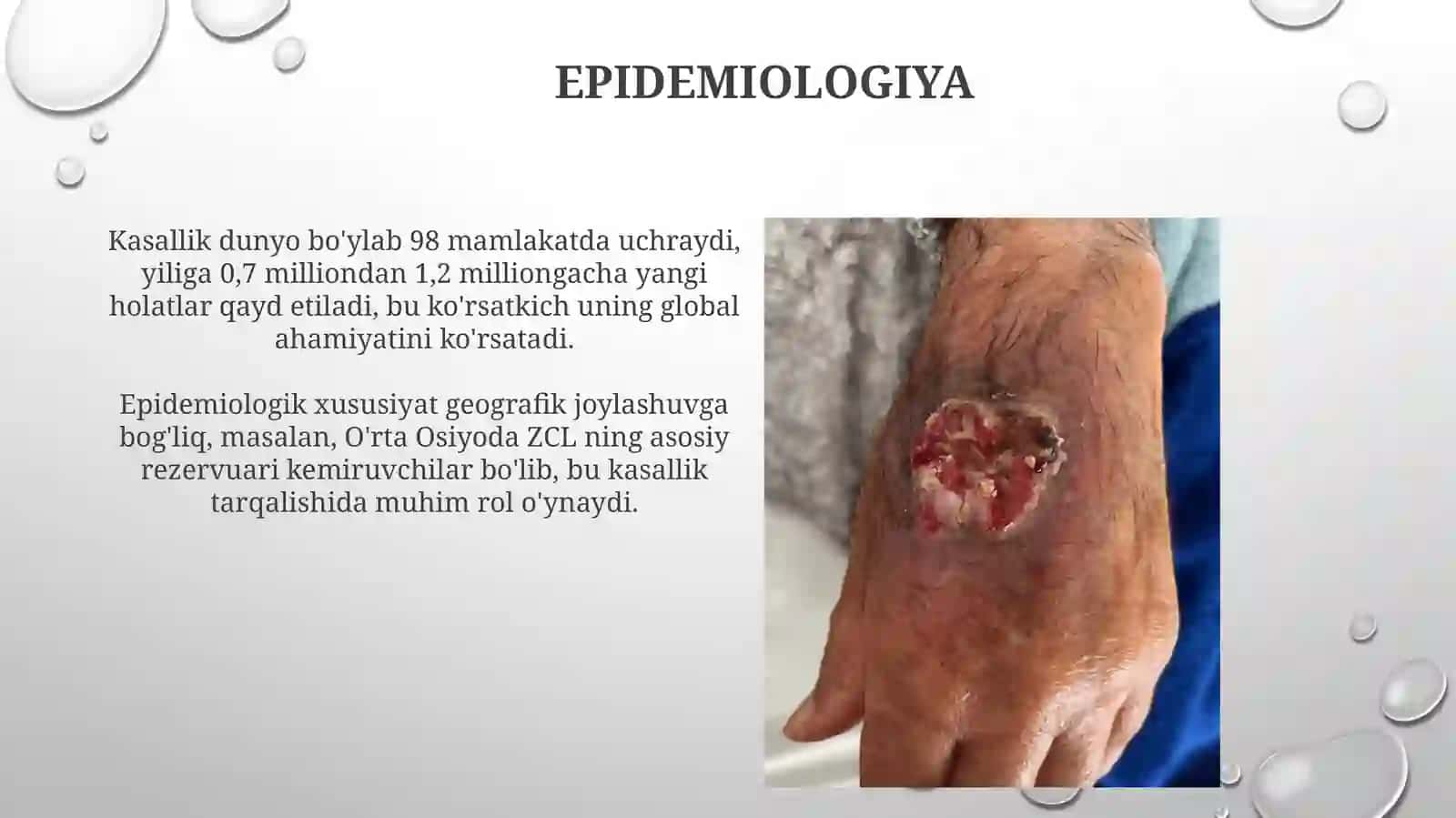 Leymanioz teri shakli etiologiyasi, epidemiologiyasi, klinikasi va davolash 4