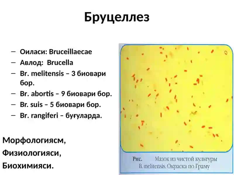Ҳавфли юқумли касалликлар 4