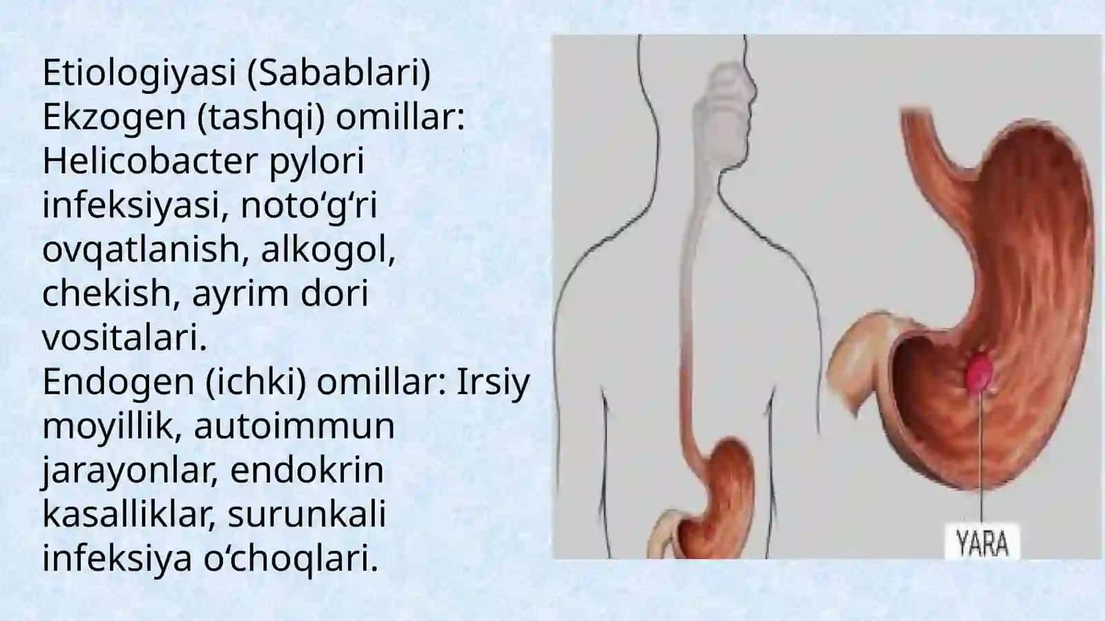 Surunkali gastrit turlari etiologiyasi patogenezi klinikasi asoratlari davolash usullari 4