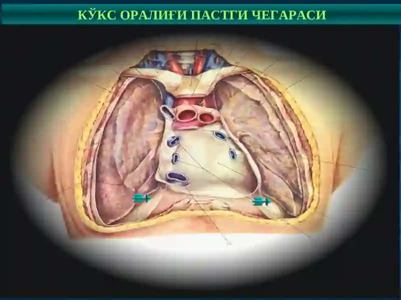 Кўкс оралиғи ва диафрагма касалликлари 4