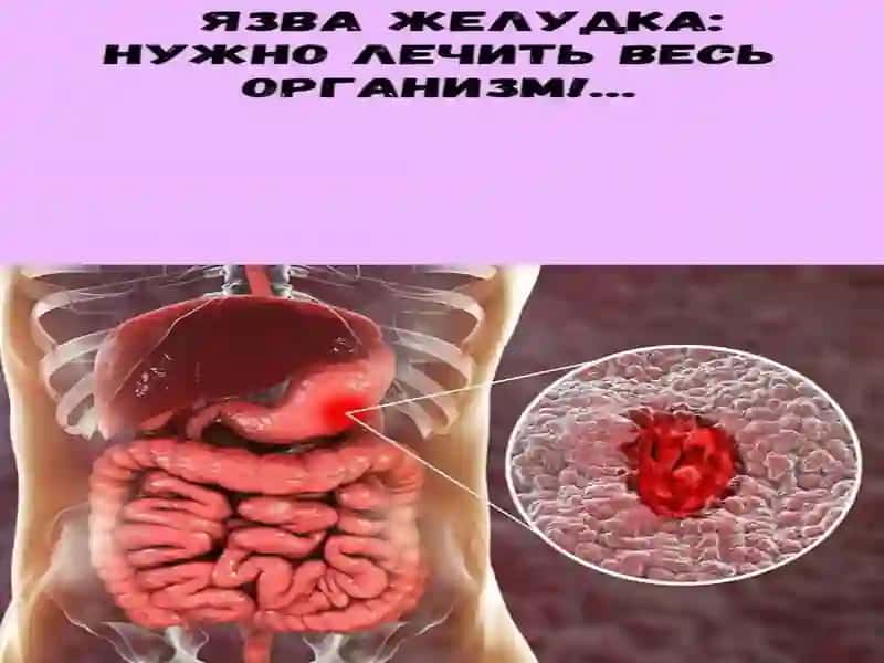 Hazm qilish tizimi patofiziologiyasi 4