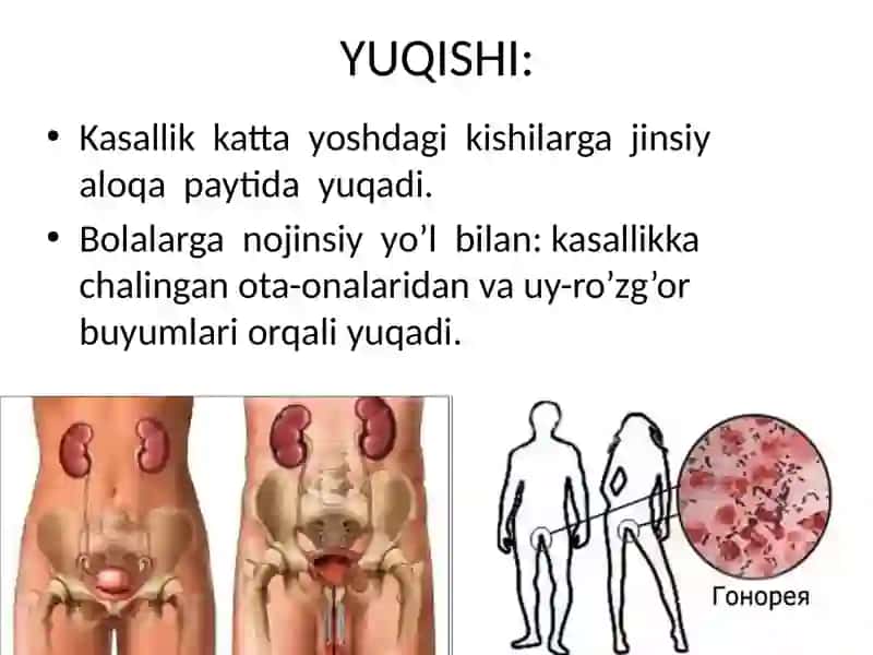 NOSPETSIFIK YARALIK OLIT 4