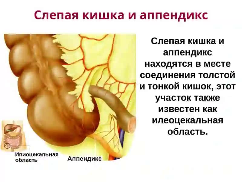 Синдром «острого живота» 4