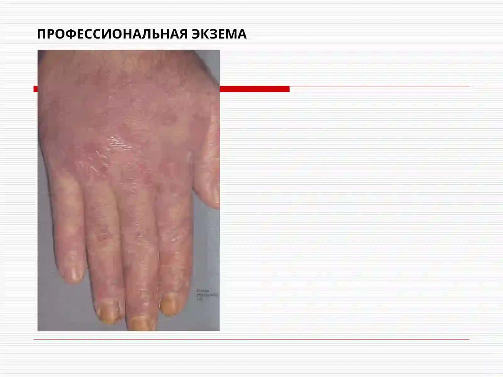 Тери таносил касалликлар фани 4