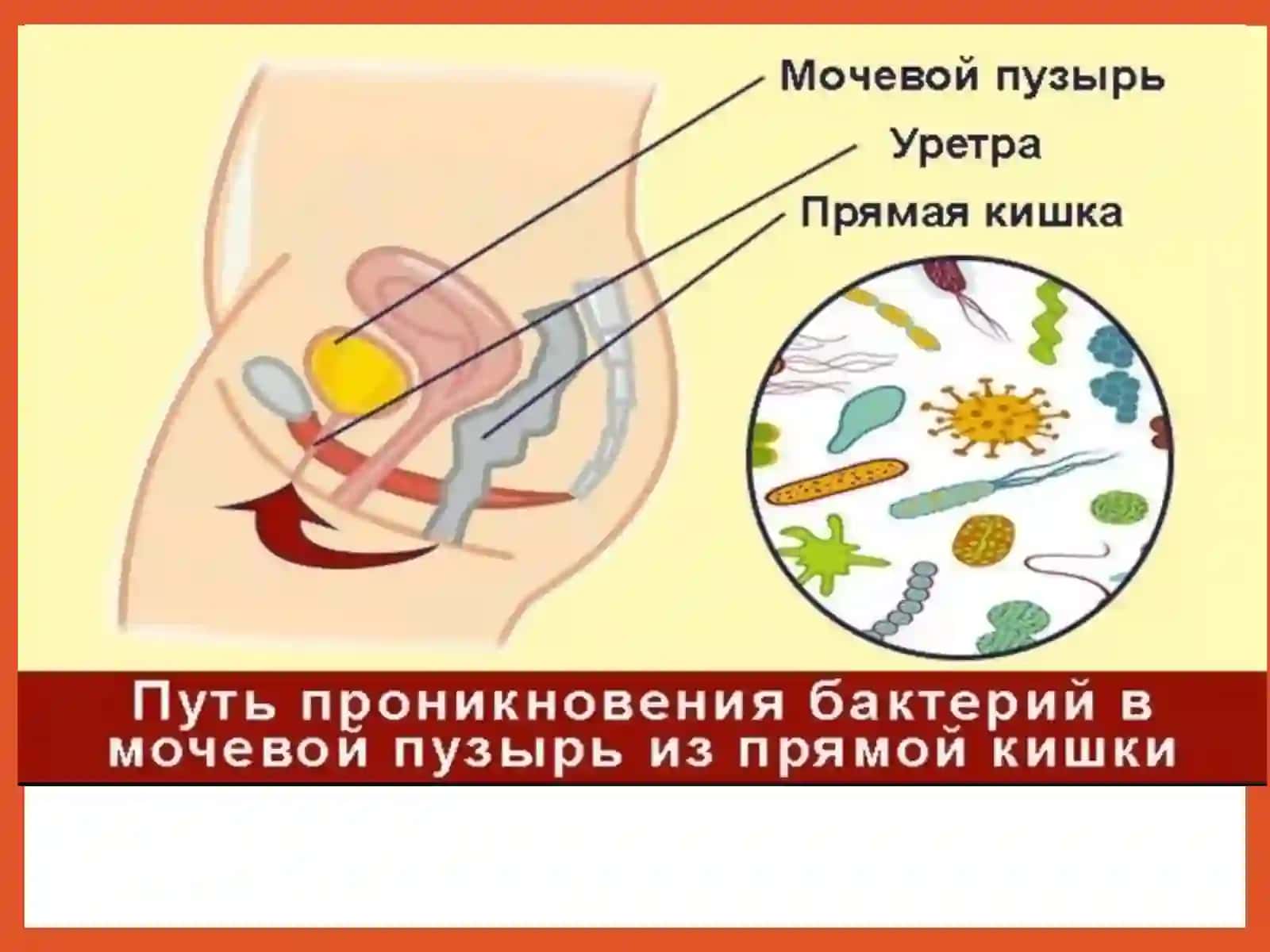 Siydiktanosil a’zolarining nospetsifik infeksion qo’zg’atuvchilari 4