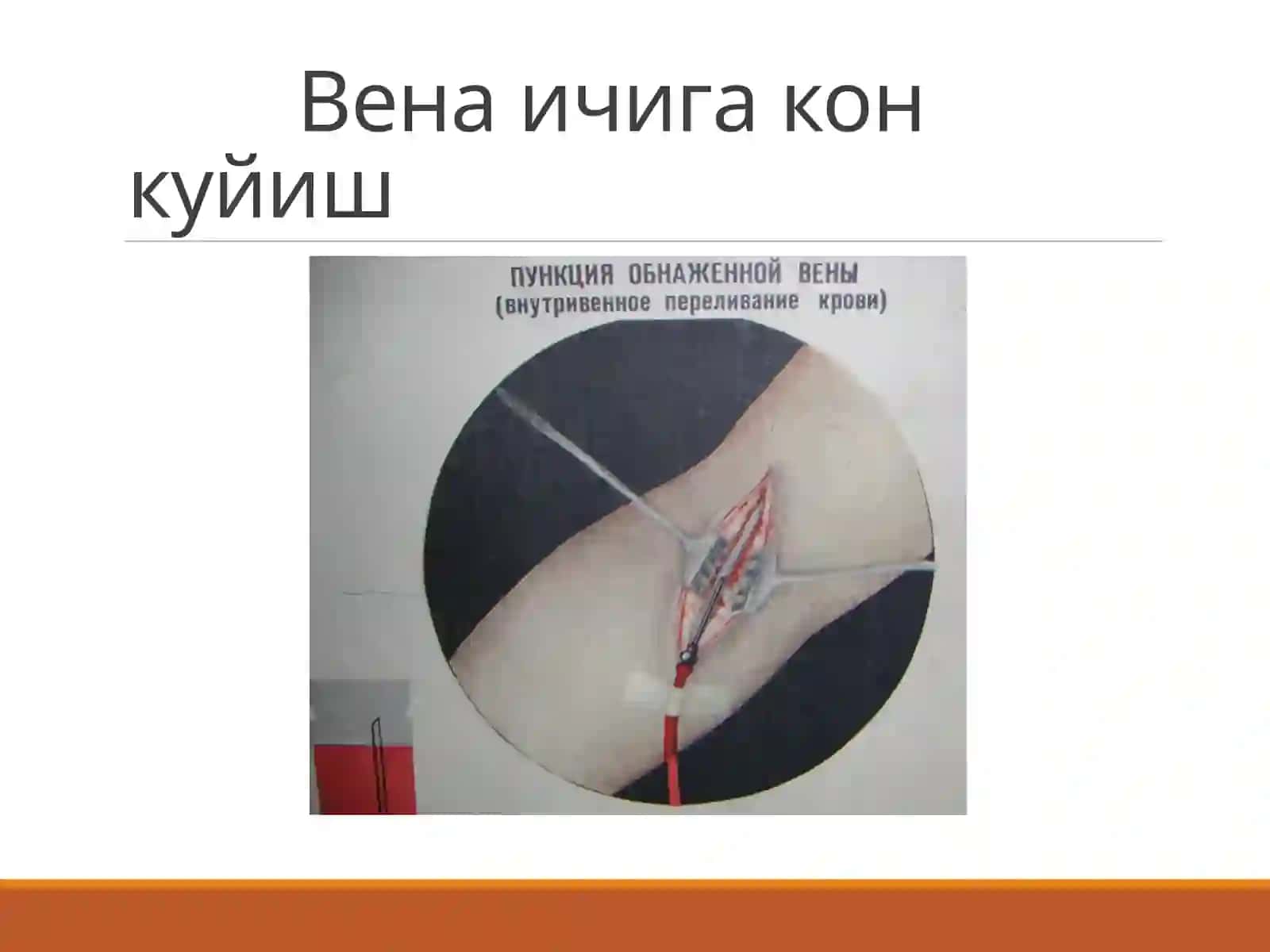 Кон куйиш турлари ва усуллари 4