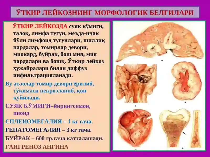 Гемопоэз 4