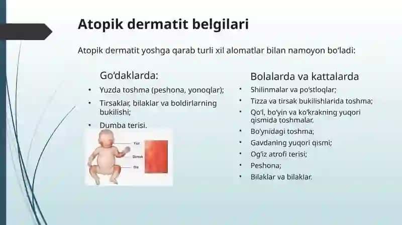 Atopik dermatitlar 4