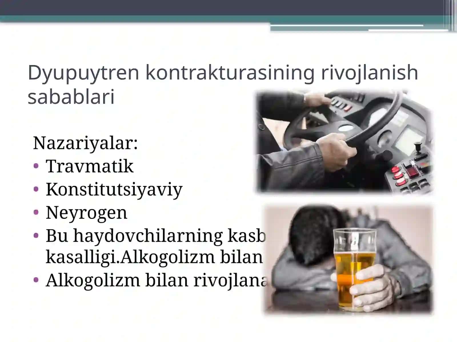 Dyupyuitren kontrakturasi 4
