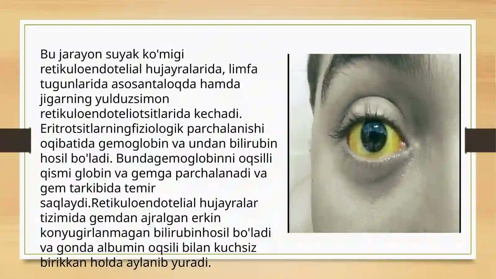 Surunkali gepatit. Klinik, labarator va instrumental tekshirish usullari 4